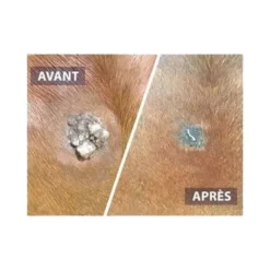 DRJ developpement Verrues, Sarcoïdes^Serkyl