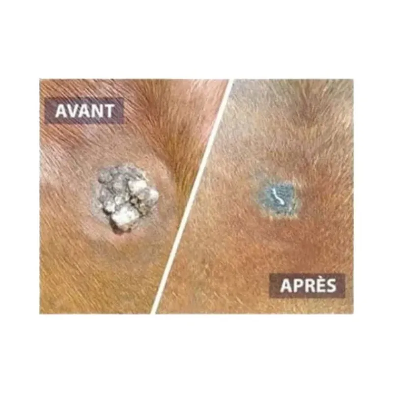 DRJ developpement Verrues, Sarcoïdes^Serkyl